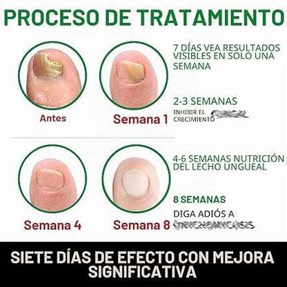 7 DAYS NAIL TRATAMIENTO