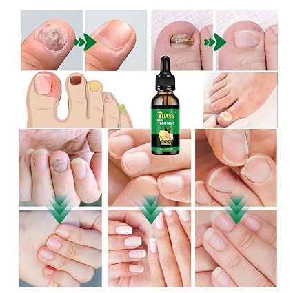 7 DAYS NAIL TRATAMIENTO