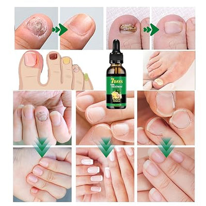 7 DAYS NAIL TRATAMIENTO